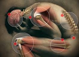 Klinische stand van zaken fibromyalgie