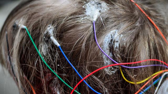 Effectieve behandeling van psychogene niet-epileptische aanvallen.