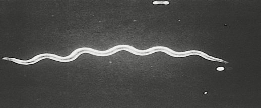 Ziekte van Lyme: hoe betrouwbaar zijn diagnostische testen?